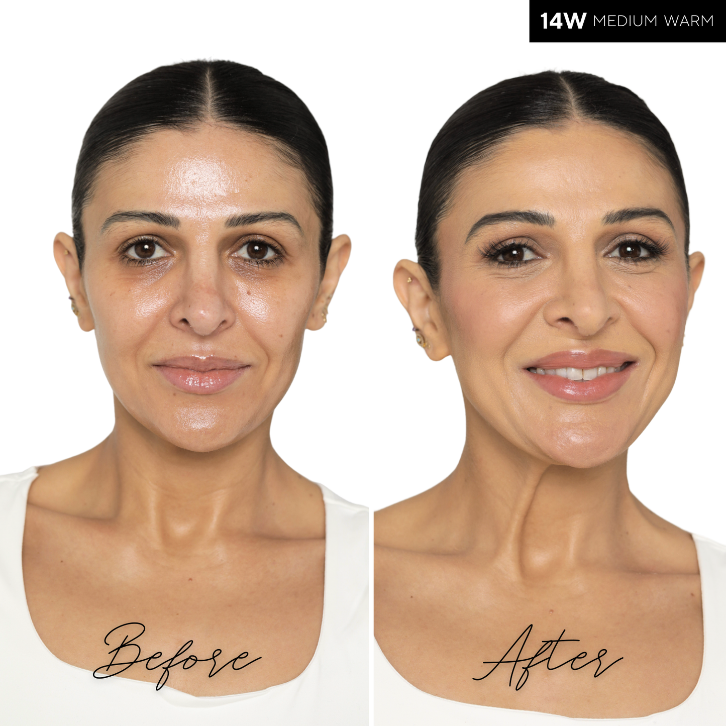 The Concealer