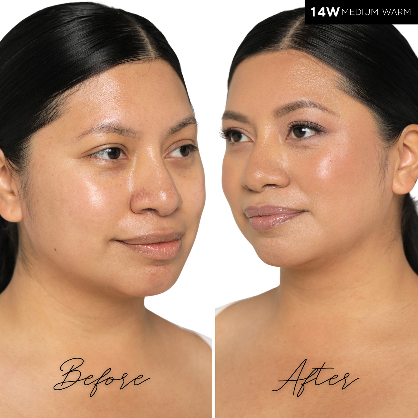 The Concealer