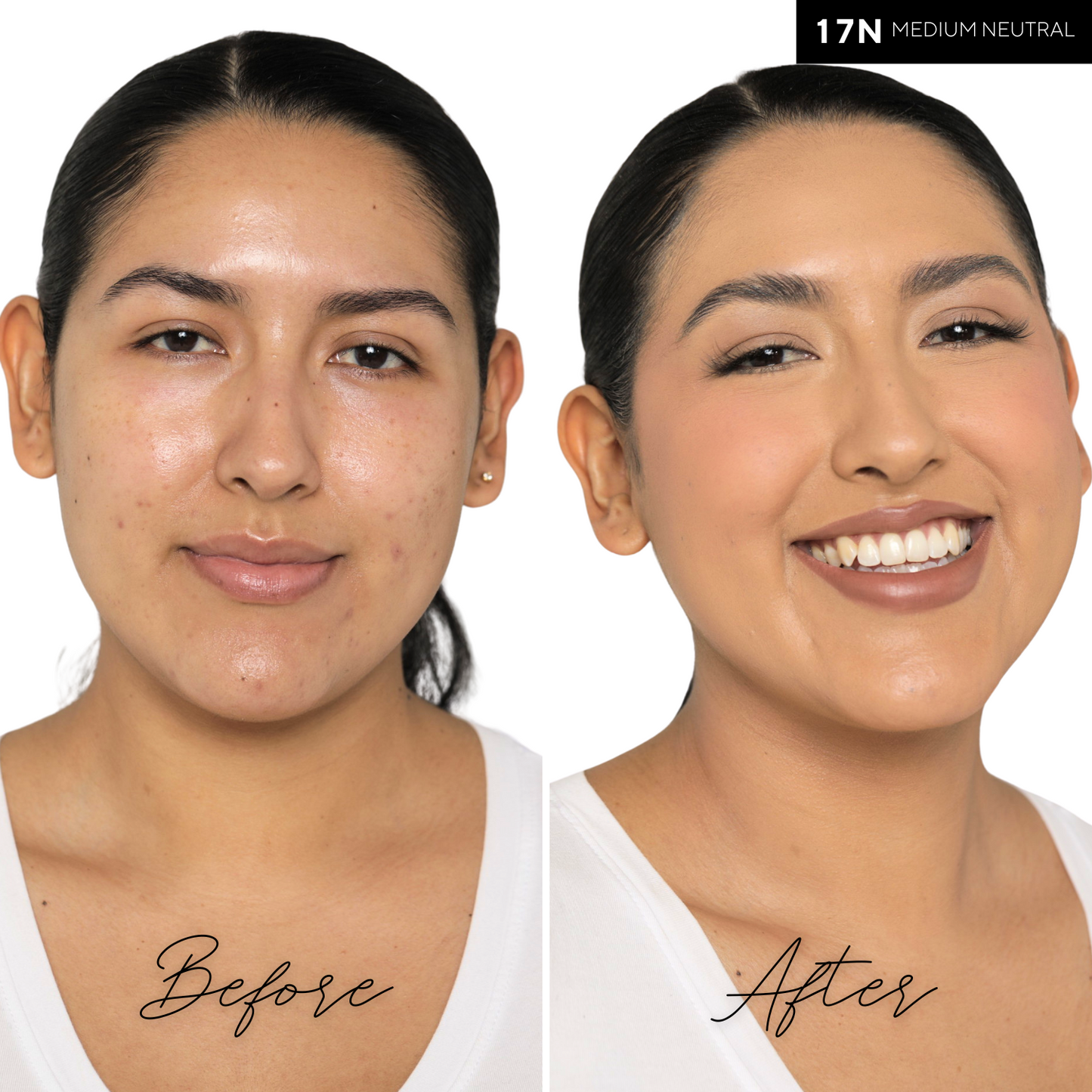 The Concealer