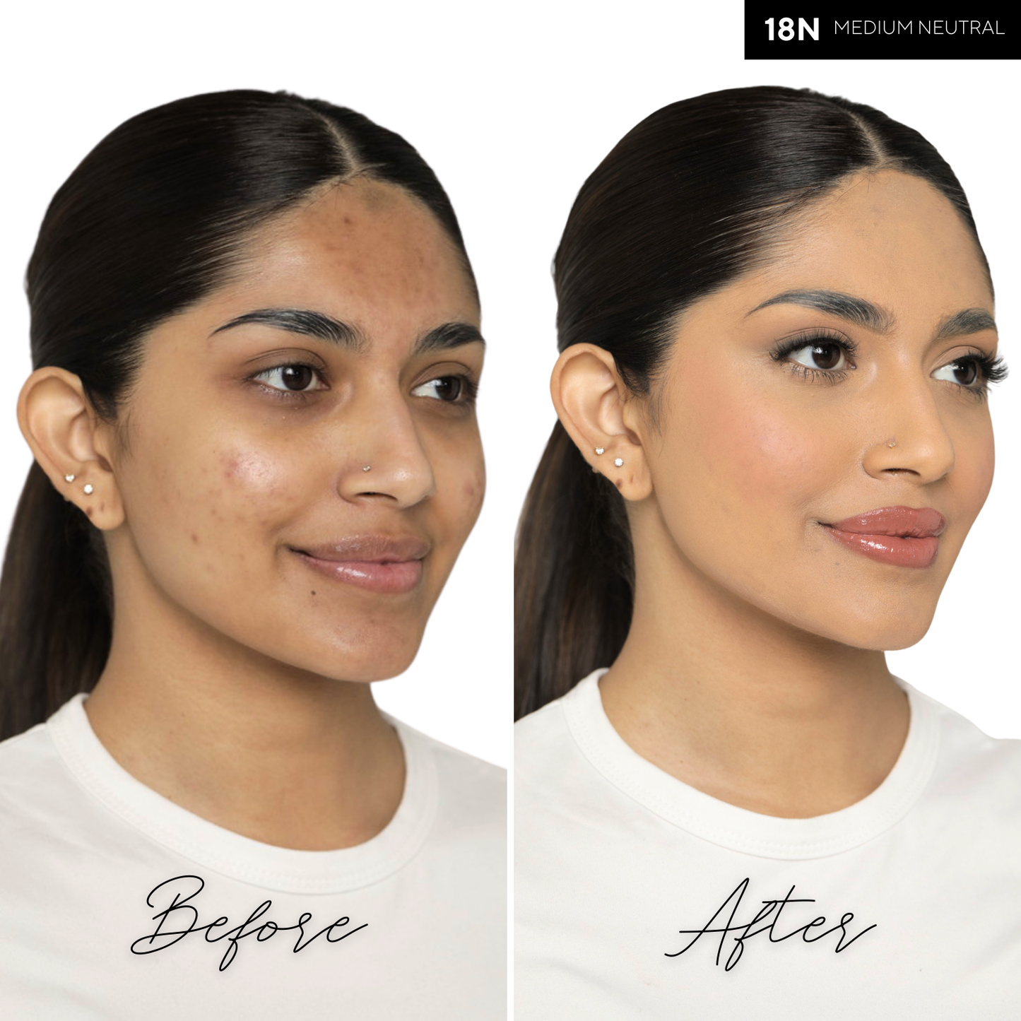 The Concealer