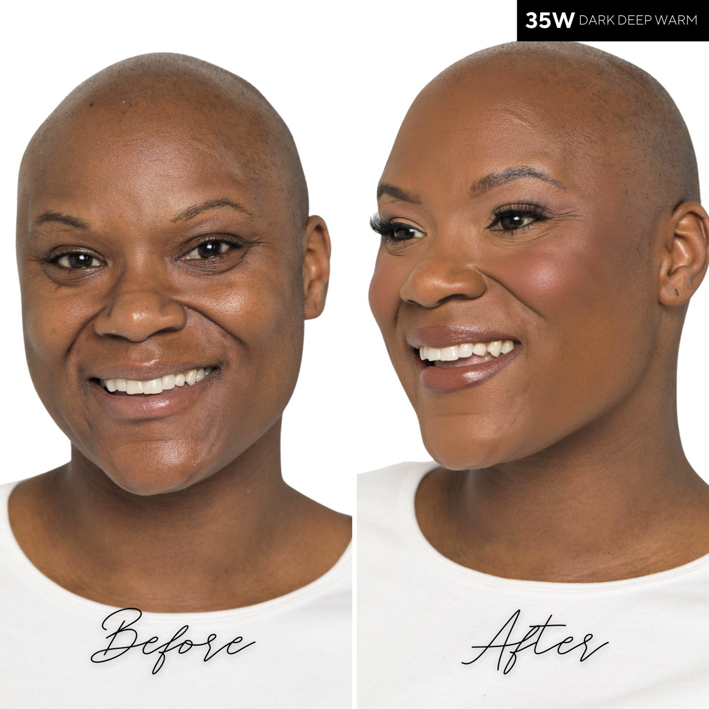 The Concealer