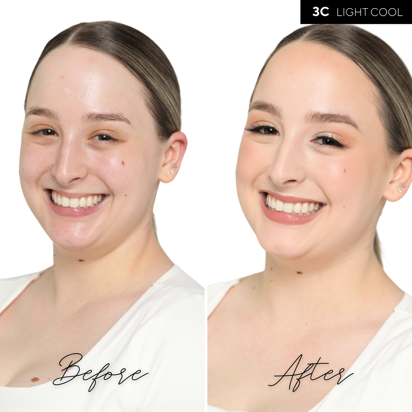 The Concealer
