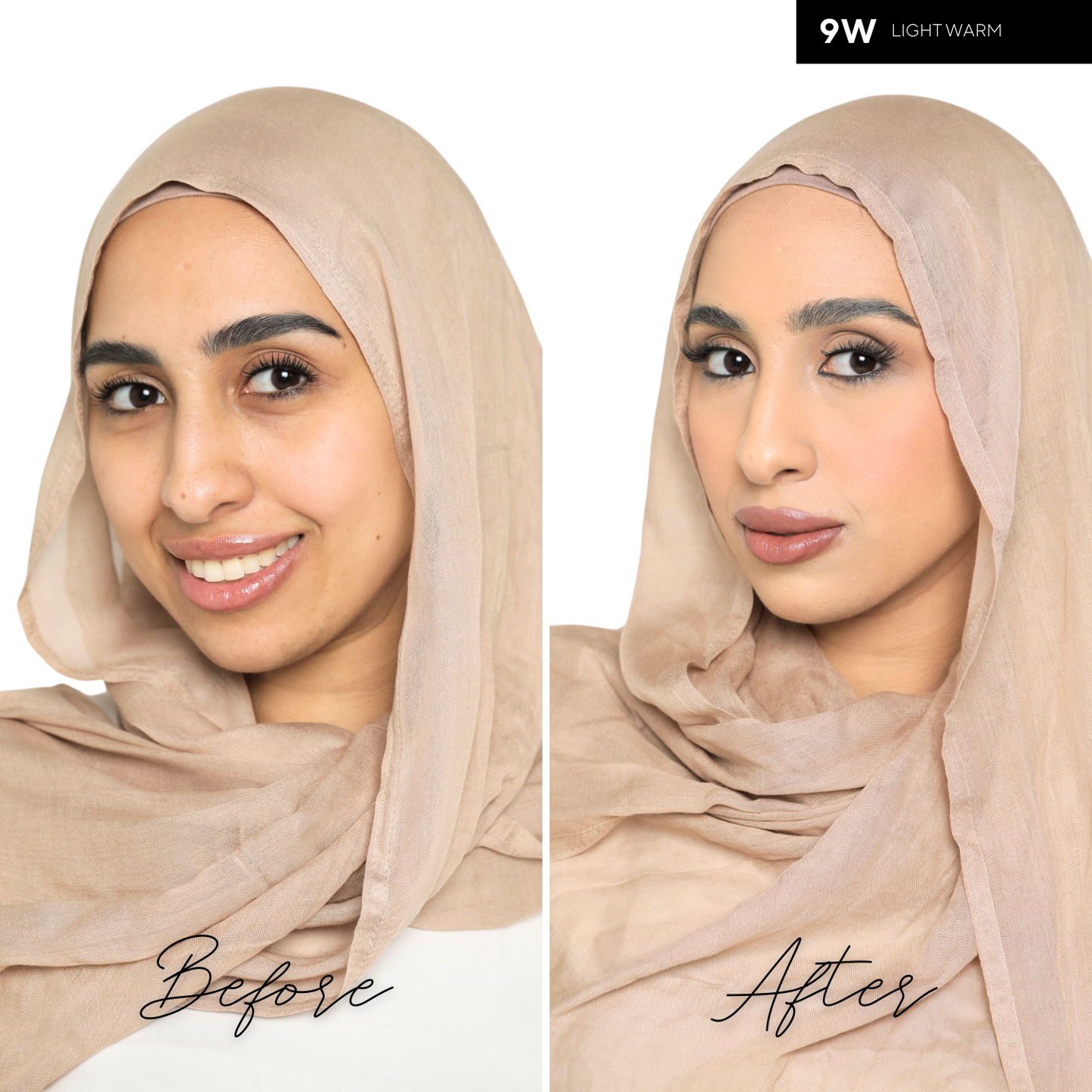 The Concealer