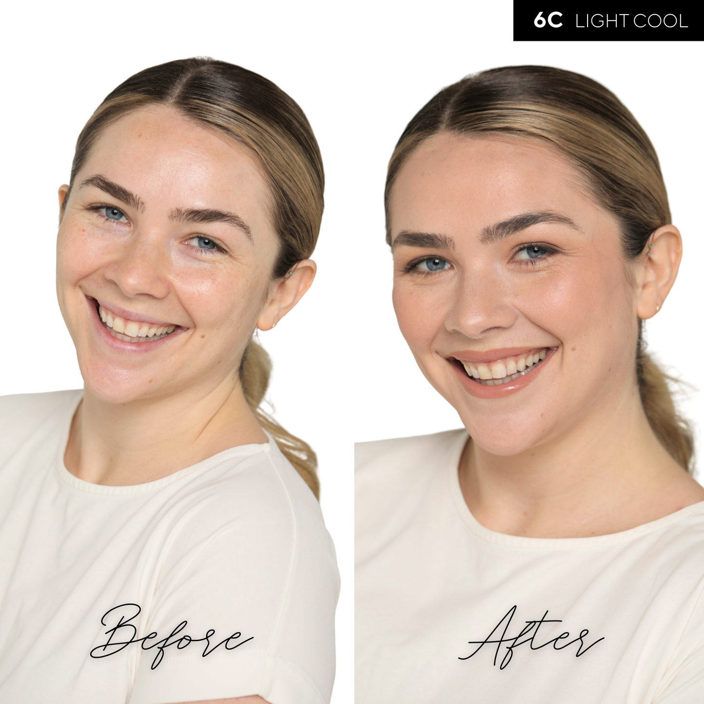 The Concealer
