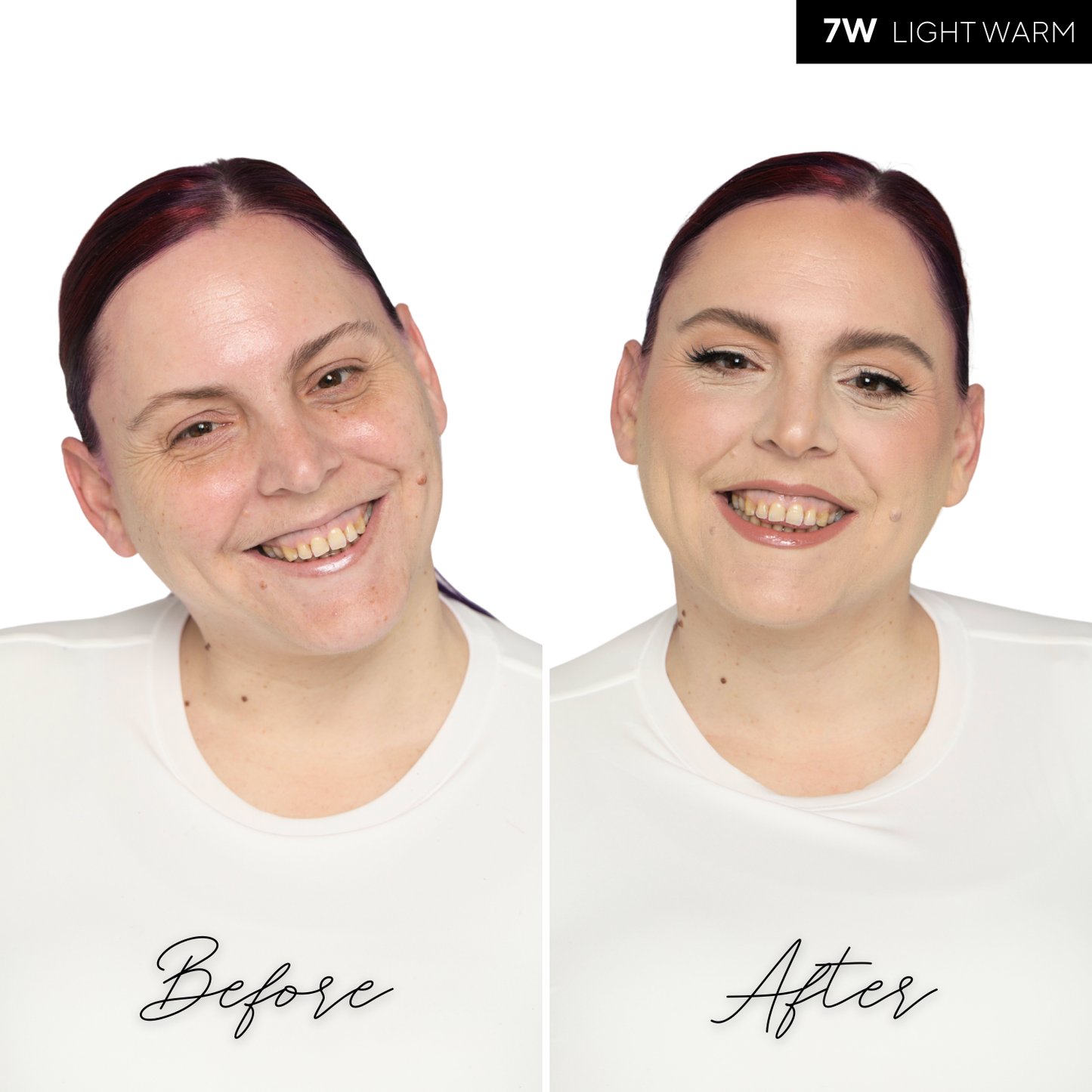 The Concealer
