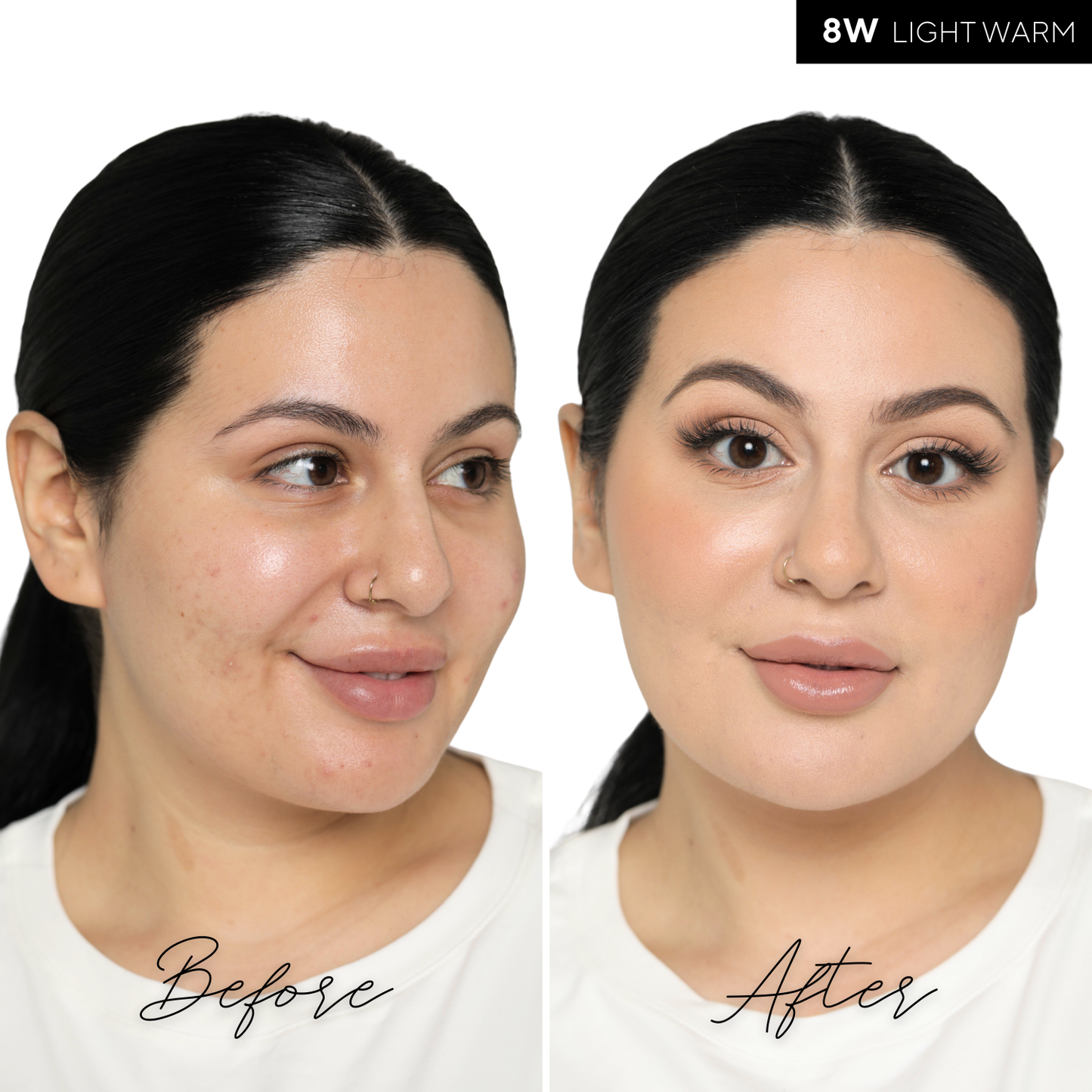 The Concealer