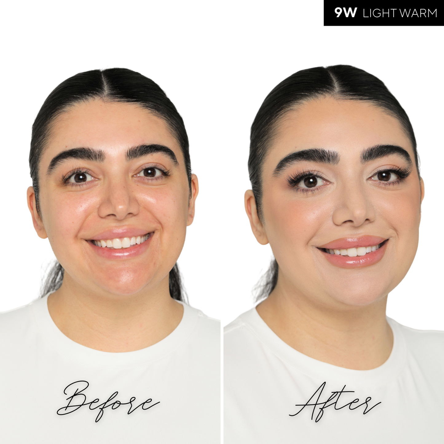 The Concealer